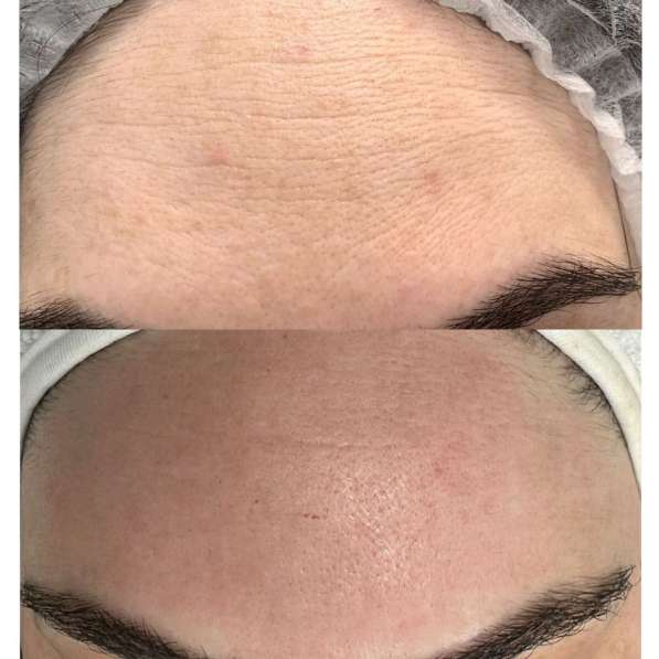 Косметолог эстет в Грозном фото 4