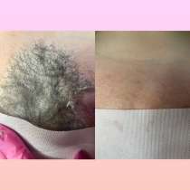 Депиляция / воск, в Воронеже